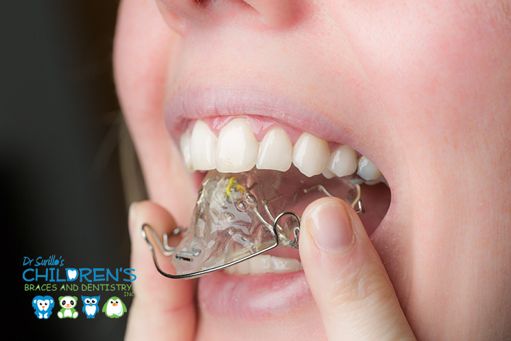 What are the Results of Not Wearing Your Retainer?